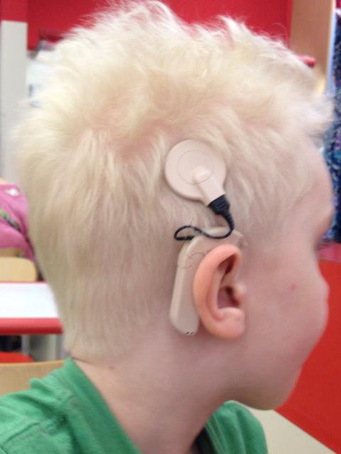 RT @starenova: Hearing restored! …